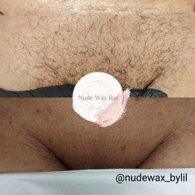 Before and after of a Brazilian Wax