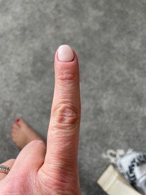 Another crooked nail