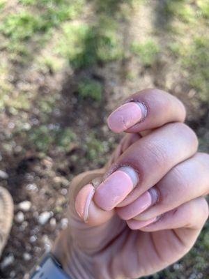 Broken nails