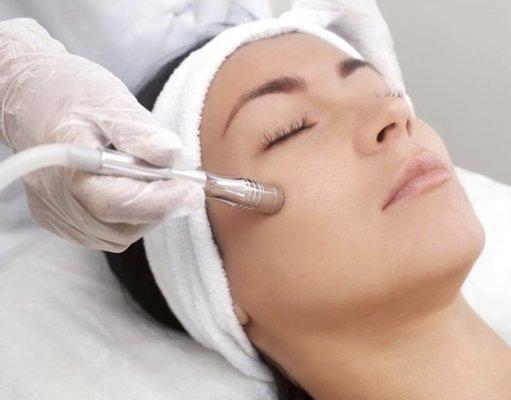 Microdermabrasion