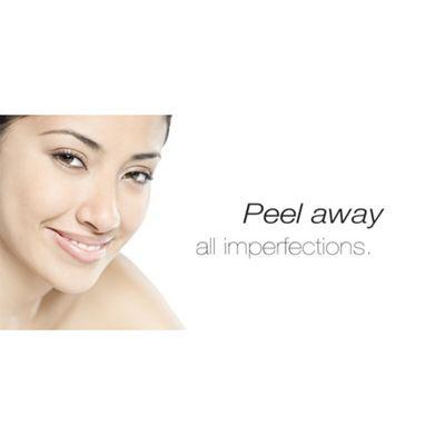 TCA, Jessner and Retinol Peels by PCA SKIN.