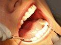 Invisalign Little Rock