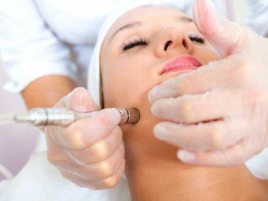 Diamond Microdermabrasion treatment