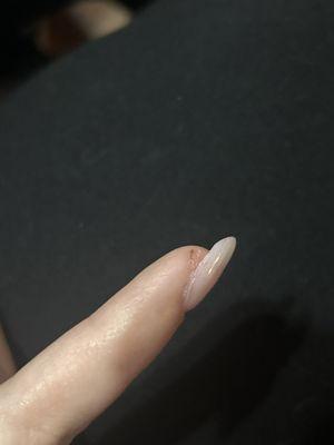 they cut my nail with the file!