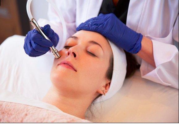 Microdermabrasion Treatment