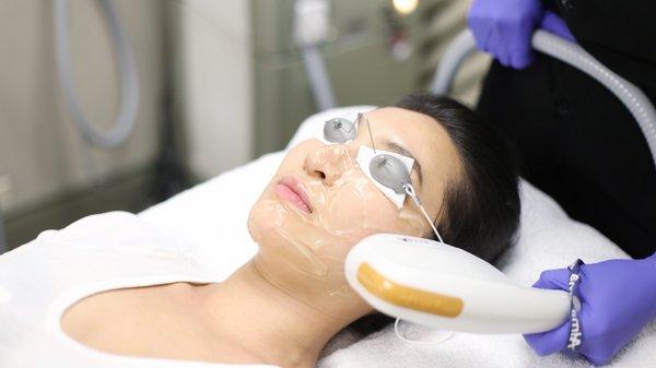 Intense Pulse Light Treatment