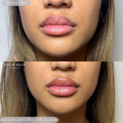 Lips by Eva