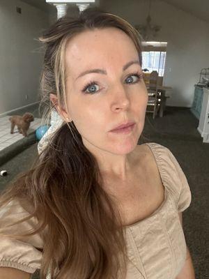 Bare unfiltered skin after hydra facial with Elyse