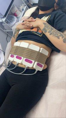 Laser Lipo no pain no down time