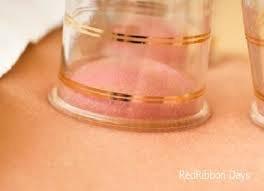 Have you ever tried cupping therapy? When not try it and see how great it can be!