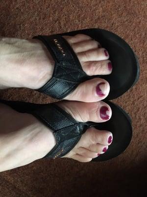 Toes after one week. Polish peeling off and I've only worn sandals.