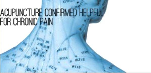 Routine acupuncture treatments can help chronic pain go away.