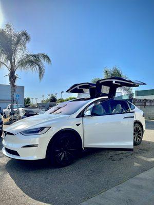 Model X came in for a Full ceramic job for the kids and was very satisfied with the work!