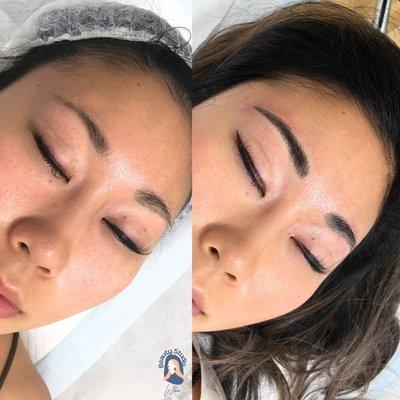 Microblading