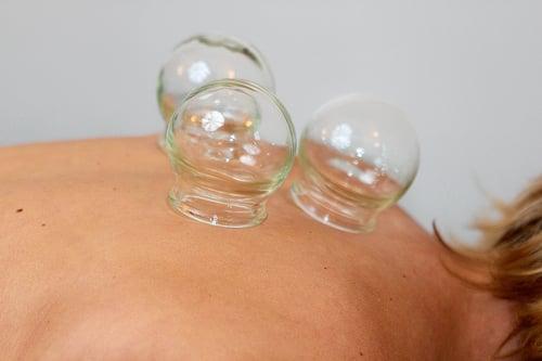 Cupping