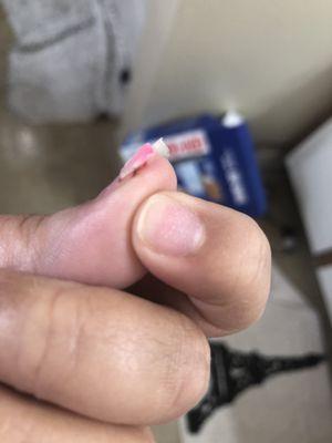 Part of my nail she ripped off.