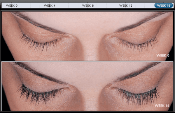 Latisse will help make your lashes thicker and longer.