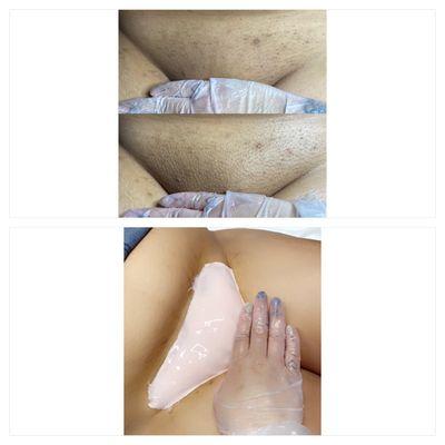 After wax Vajacial to smooth skin and relieve irritation