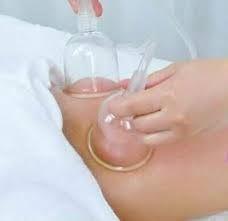 Dynamic cupping can be used to gently encourage lymphatic uptake