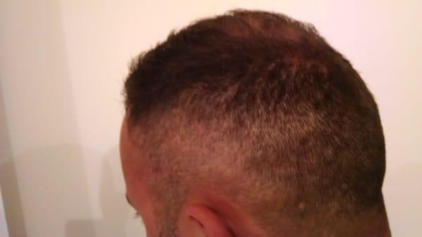 Zigzag fade