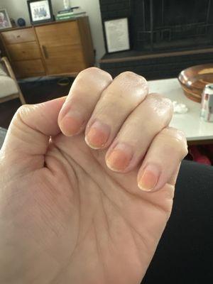 Damaged nails from their basic manicure