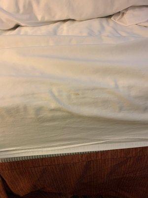 Stains on sheets.