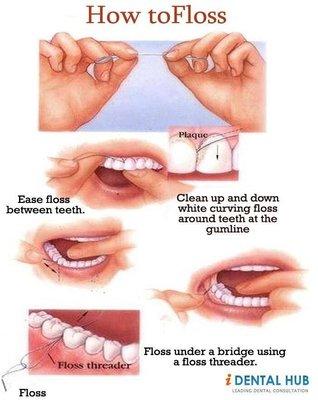 Easy Flossing Technique