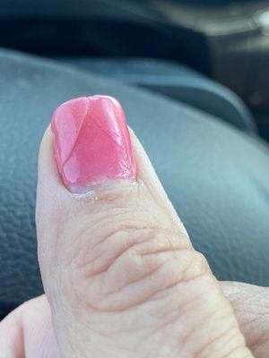 Broken nail.