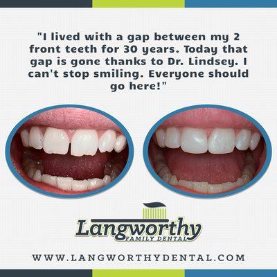 We'll help get your smile back!