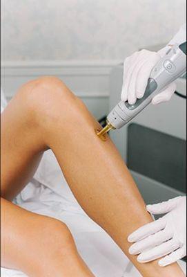 Laser hair removal is a permanent solution to your unwanted hair. At Augusta Laser and Skin, we guarantee low competitive prices.