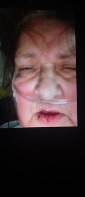 The nurse punched her in the face twice & in the stomach & she is 70 yrs old.