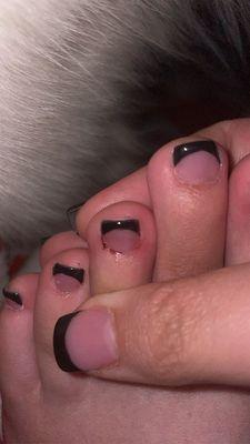 Bleeding toes