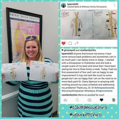 Hannah's severe back pain has decreased in just a few weeks!