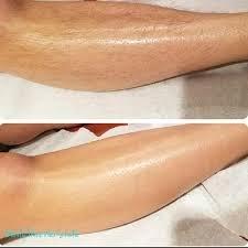 Before and After leg wax