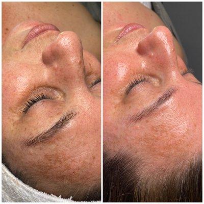 Gua Sha Facial before and after