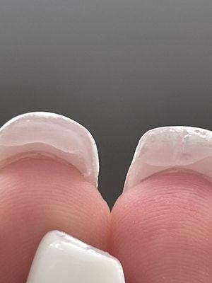 Clumps of acrylic under nail