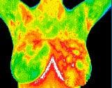 Thermograms are a radiation-free, pain-free option to monitor your breast health.