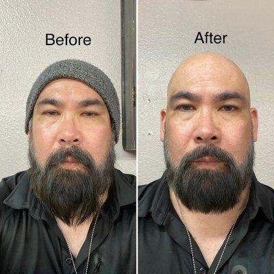 Simple before and after photos.