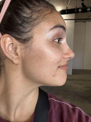 Post facial glow side profile 2