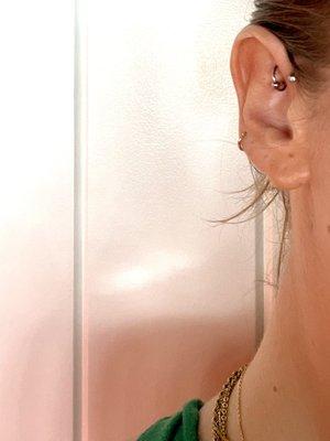 forward helix + rook