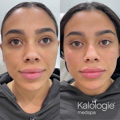 Kalologie Medspa Paradise Valley