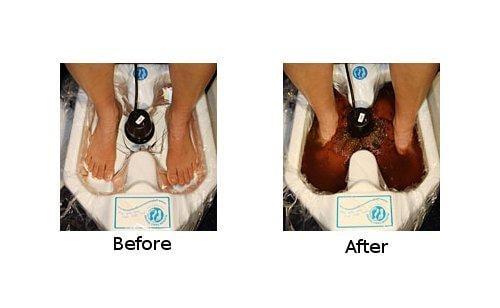 ionic foot spa treatments 
 great way to jump start your health