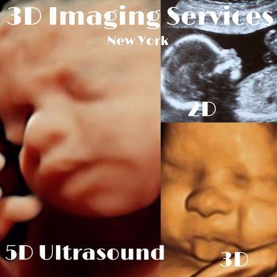 5D Ultrasounds now available. Calll 212-462-4464 to schedule your appointment 212-462-4462