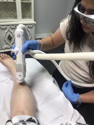 Laser Hair Removal that is gentle & safe for all skin tones!