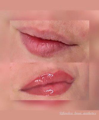 Lip blushing