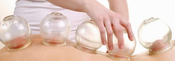 Relieve pain with cupping