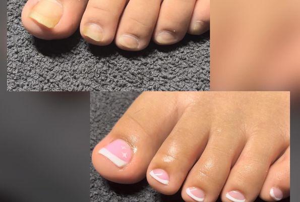 Before and After pedicure