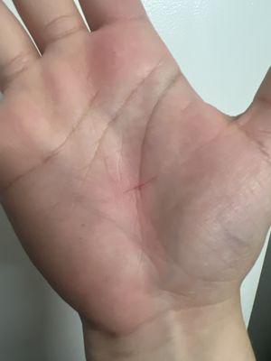 The cut I got from using their crappy products