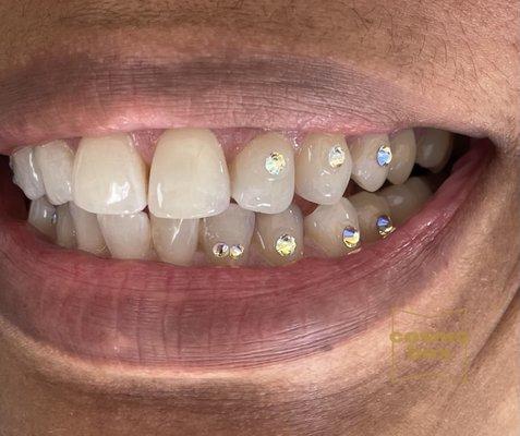 A Swarovski Crystal side "Grill" Tooth Gems.