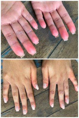 Her nails after being forced by the technician to soak for hour and a half.